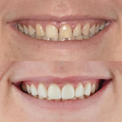 Are You Ready for a Smile Transformation? Magic Smile Midtown Can Help